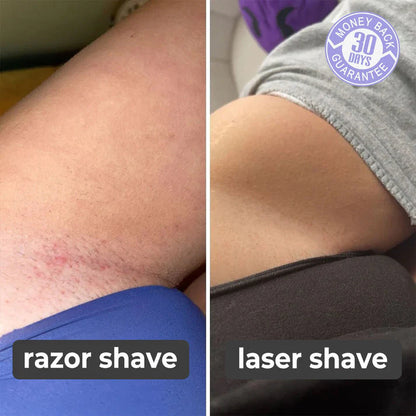 LASER HAIR REMOVER